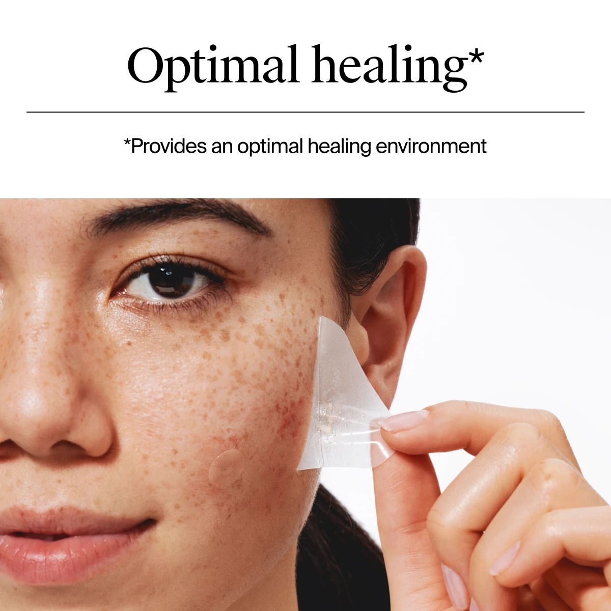 NA-US-NTG-Acne-TrianglePatch-Texture-ATF6-Amazon-3000x3000.webp