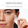 NA-US-NTG-Acne-TrianglePatch-Texture-ATF6-Amazon-3000x3000.webp