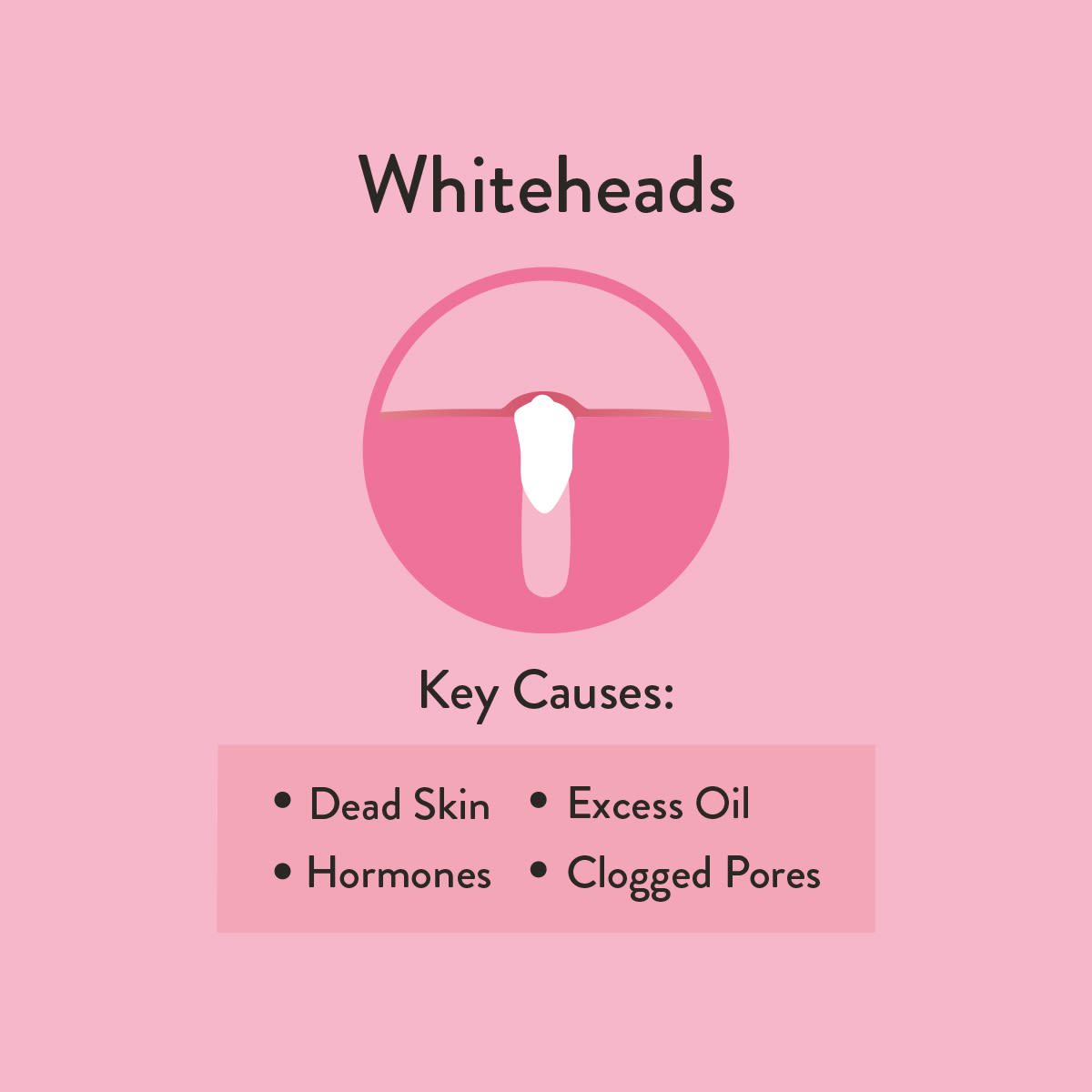 Whiteheads