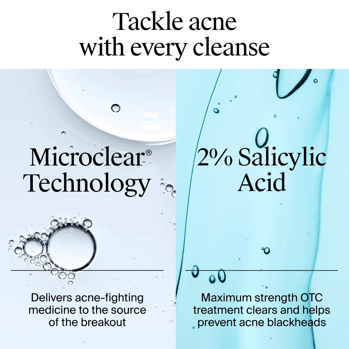 Split panel showing Microclear technology and 2 percent salicylic acid for acne care.