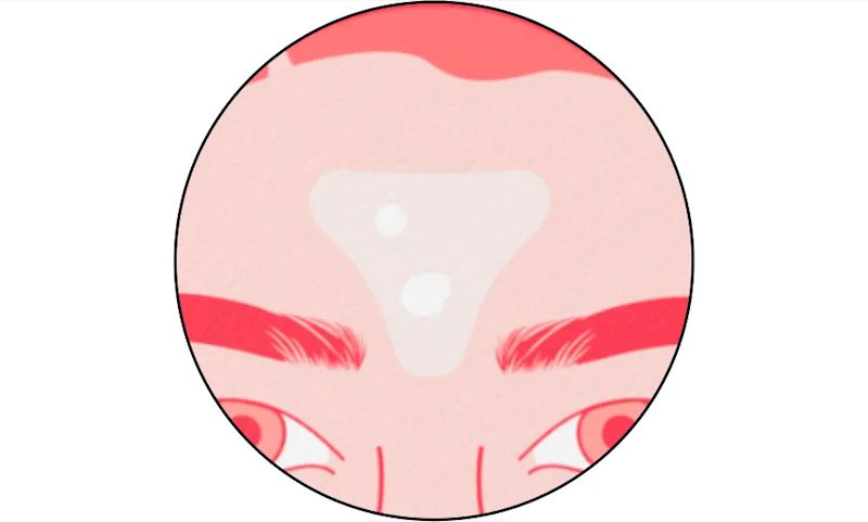 Leave each patch on for 6 hours or overnight. Patch starts to turn white as it absorbs fluid.