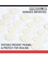 Neutrogena Stubborn Acne® Ultra-Thin Blemish Patches