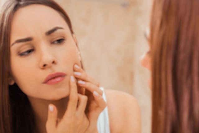 How to Prevent Acne with a Proper Skin Care Routine