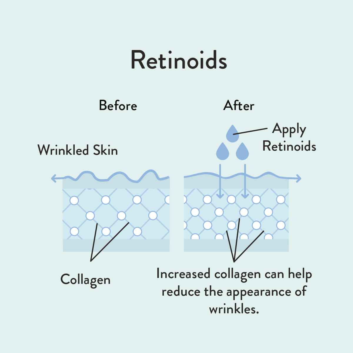 Retinoids