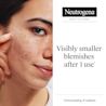 NTG EMEA UK 3574661839271 Clear Def Thin Blemish Patch 24pcs SI01 CLA JPG