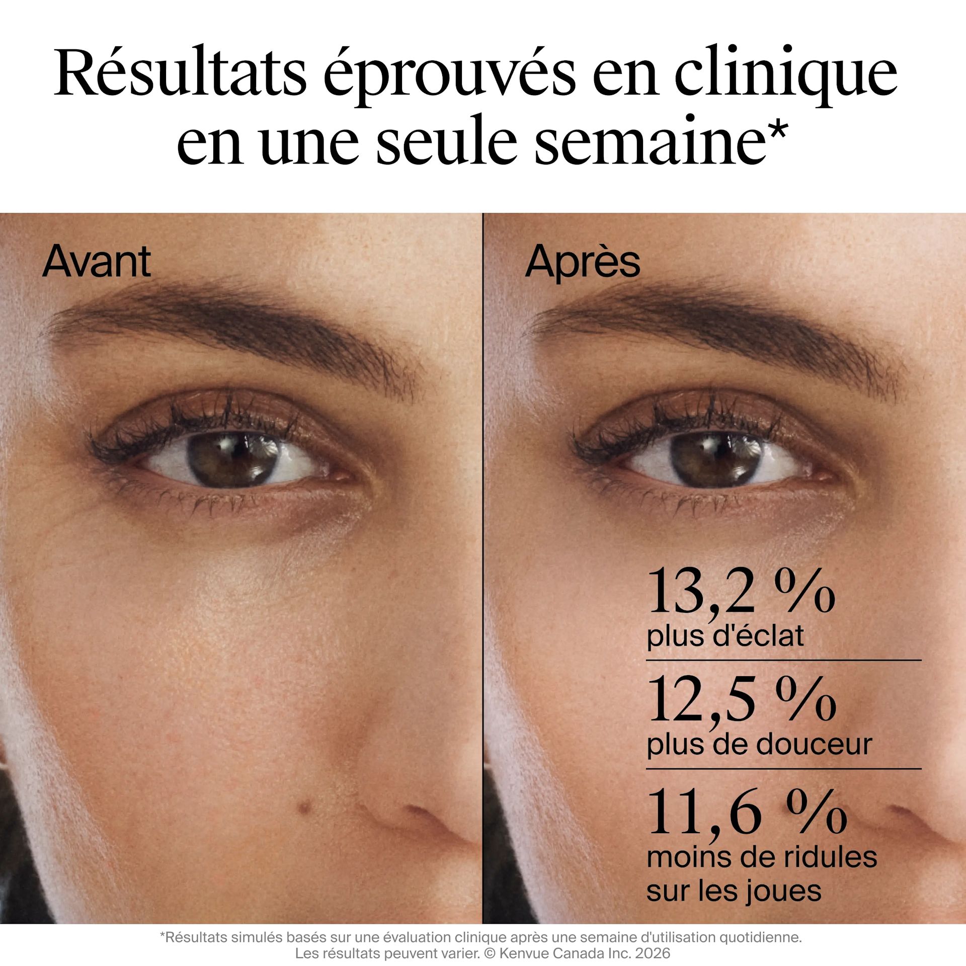 Neutrogena Rapid Wrinkle Repair Retinol Renewal Serum - Image 5