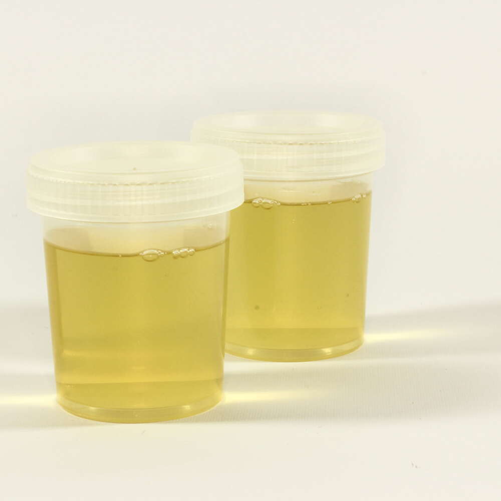 Does Having Clear Urine Really Mean You Re Well Hydrated By Precision Hydration