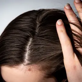 Mujer exponiendo su cuero cabelludo grasoso