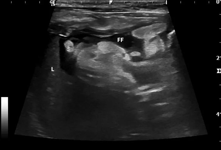 Abdominal ultrasound images from a cat. 