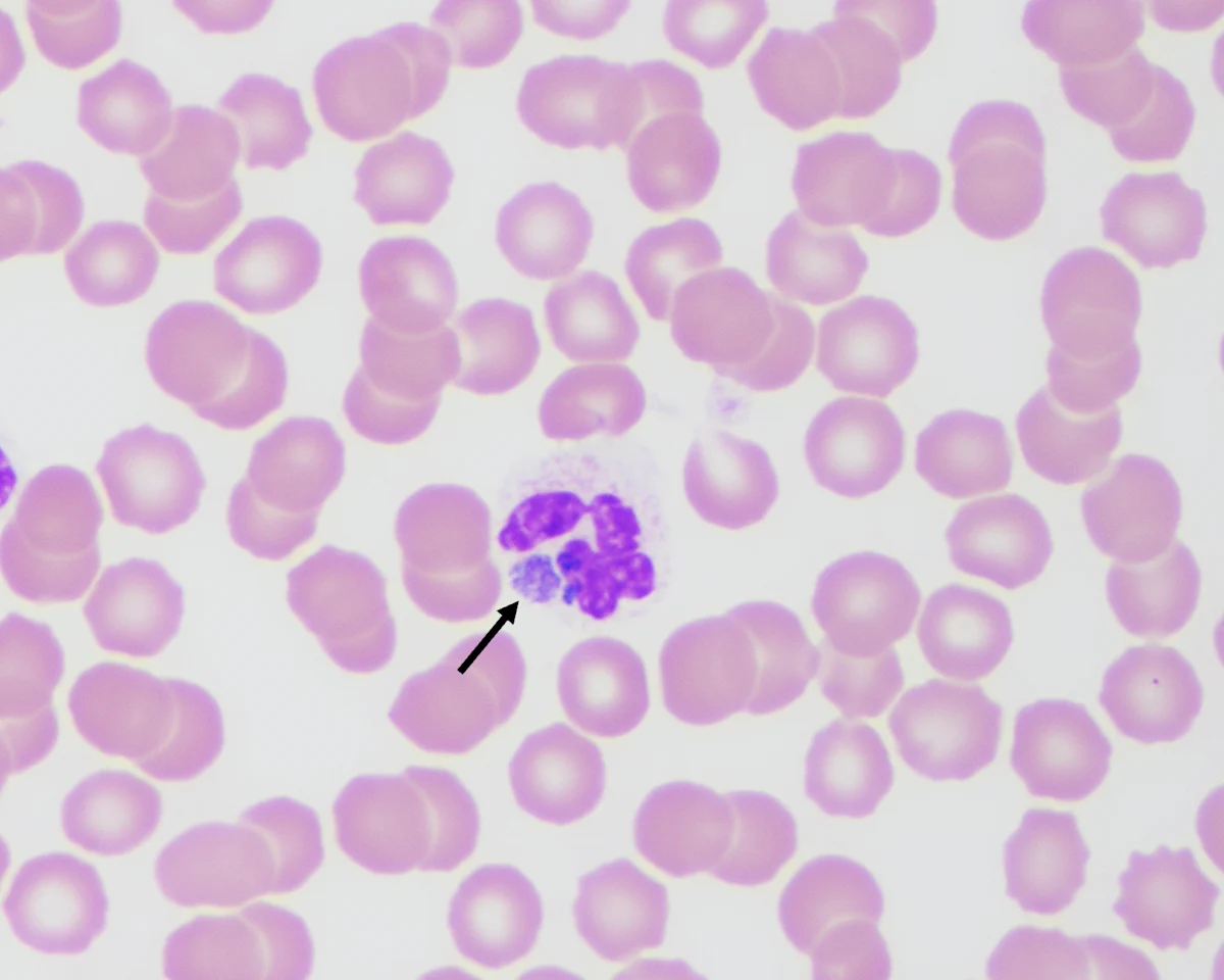 Arrow pointing to a round, purple-stained organism within cytoplasm of a neutrophil surrounded by red blood cells.