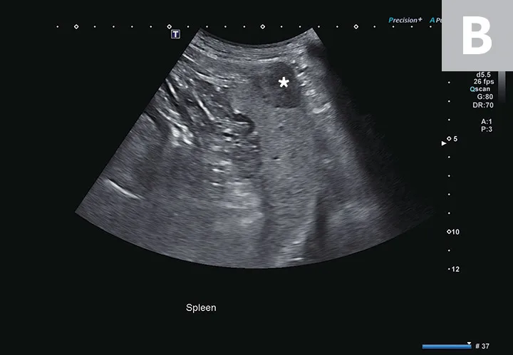 Two ultrasound images showing a hyperechoic mass in the liver and a hypoechoic mass in the spleen of a dog.