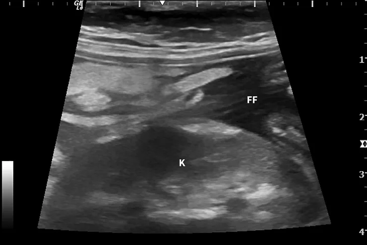 Abdominal ultrasound images from a cat. 