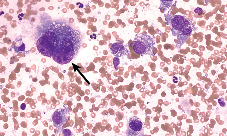 histiocytic-sarcoma-imaging-in-dogs