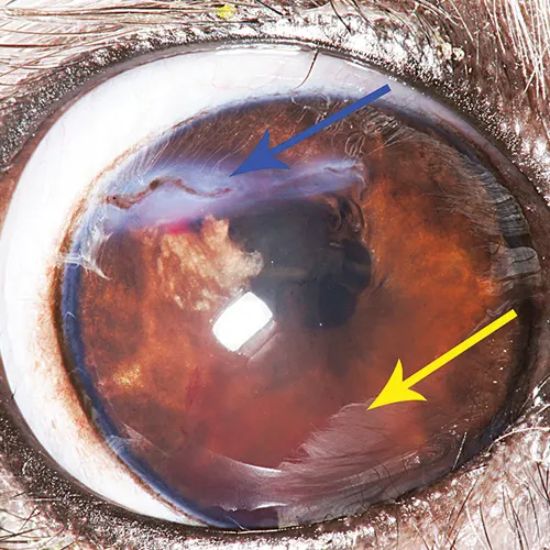 Eye with white streak running across dorsal cornea and cloudy density of varying color in ventral half of anterior chamber.