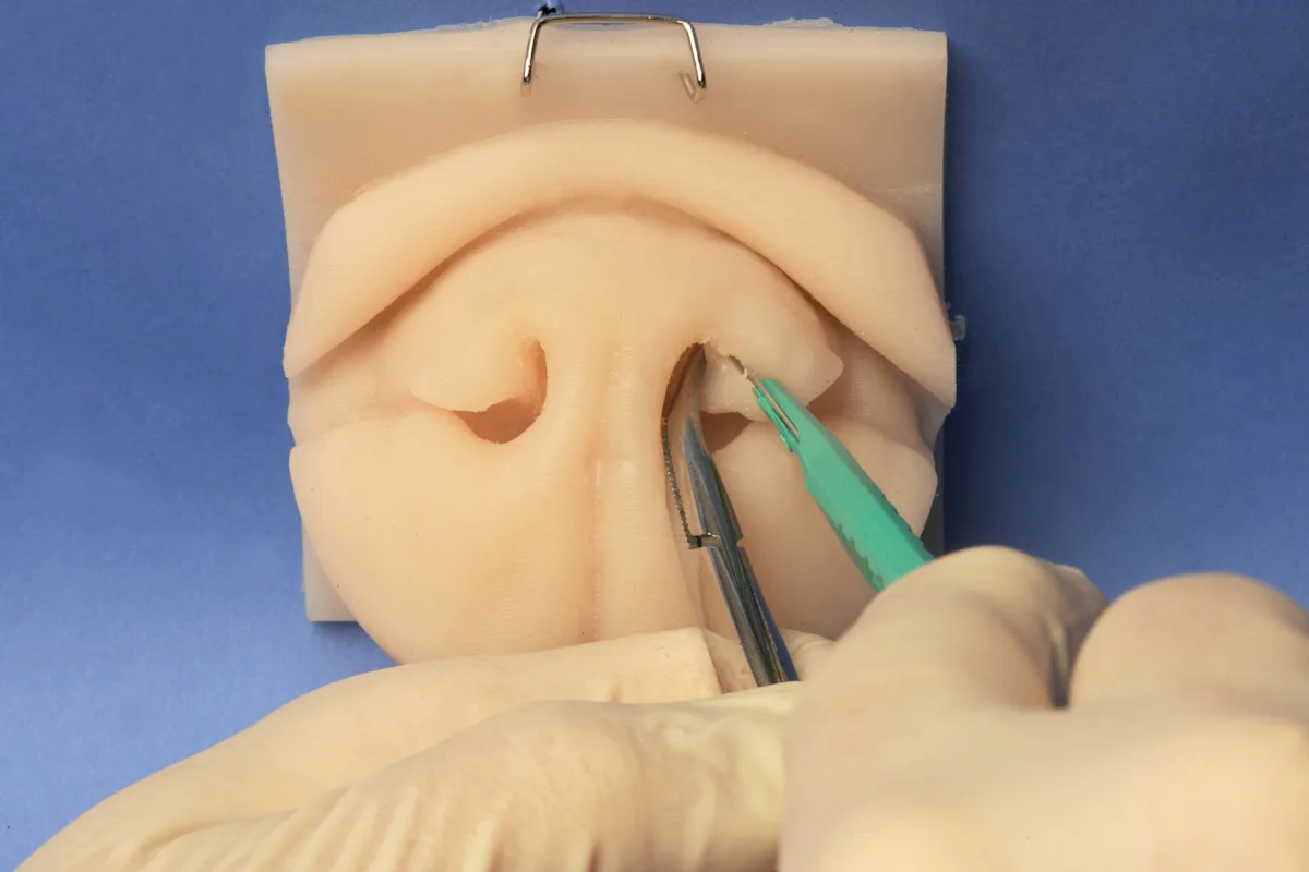 Hemostats grasping the alar fold of a silicone model of a dog's nose while a scalpel incises the alar fold in a ventrolateral direction