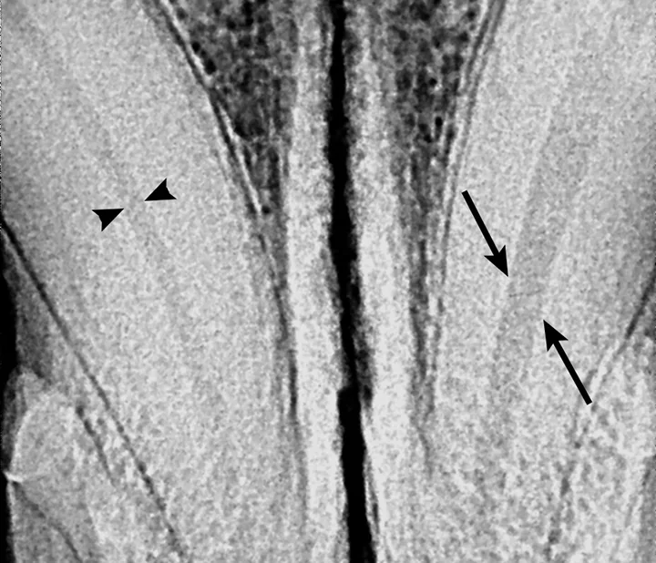 selected slide image