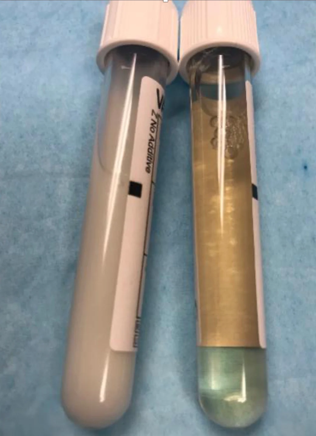 Glass vial with white creamy fluid lying alongside vial with clear fluid.