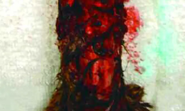 Featured Image