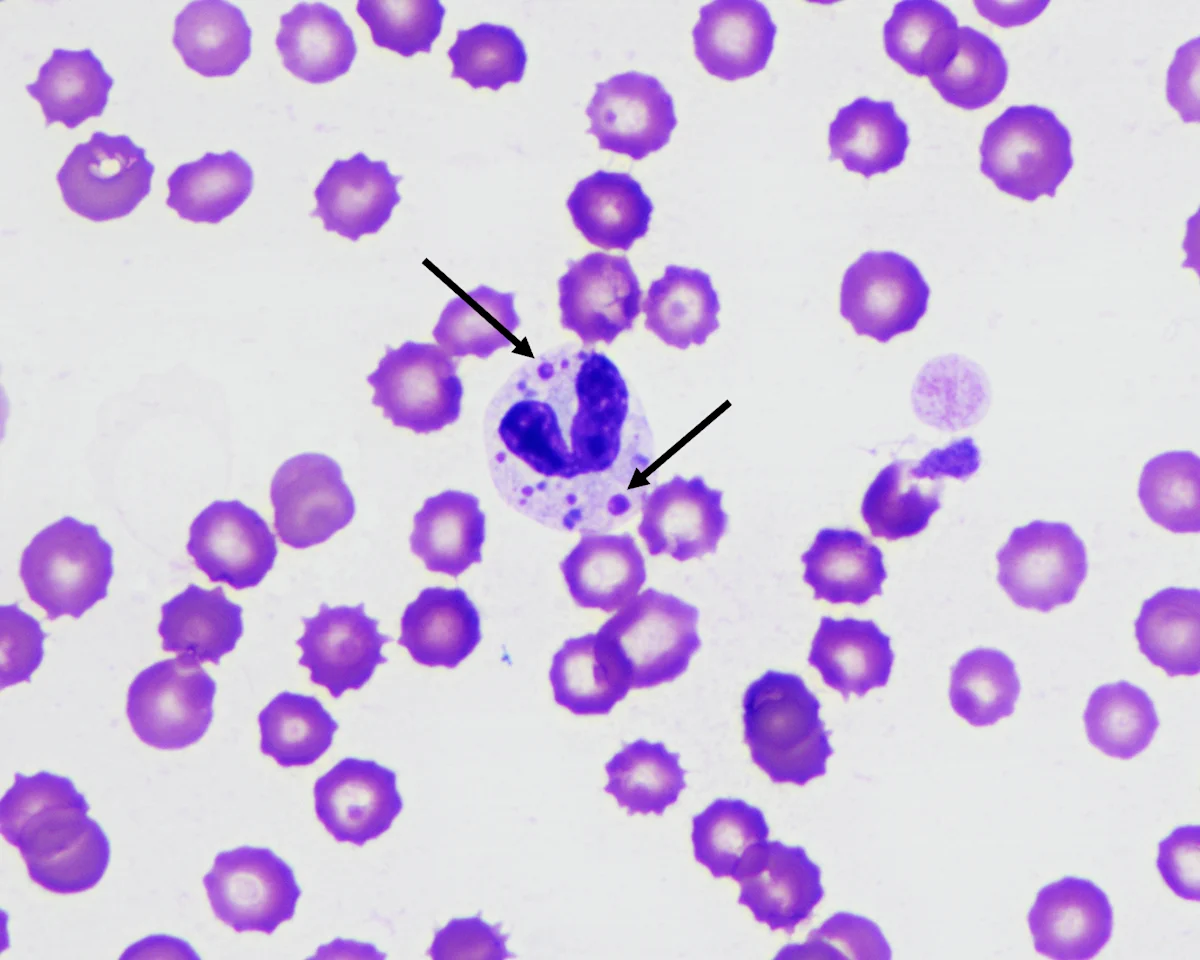 Arrows pointing to multiple purple, round organisms of variable size located within the cytoplasm of a neutrophil.