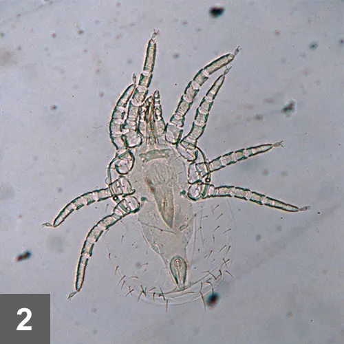 A microscopic image of a poultry mite.