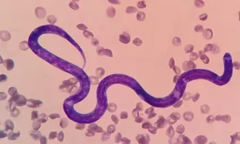 Magnified slide image of a single purple-stained heartworm larva surrounded by numerous RBCs.
