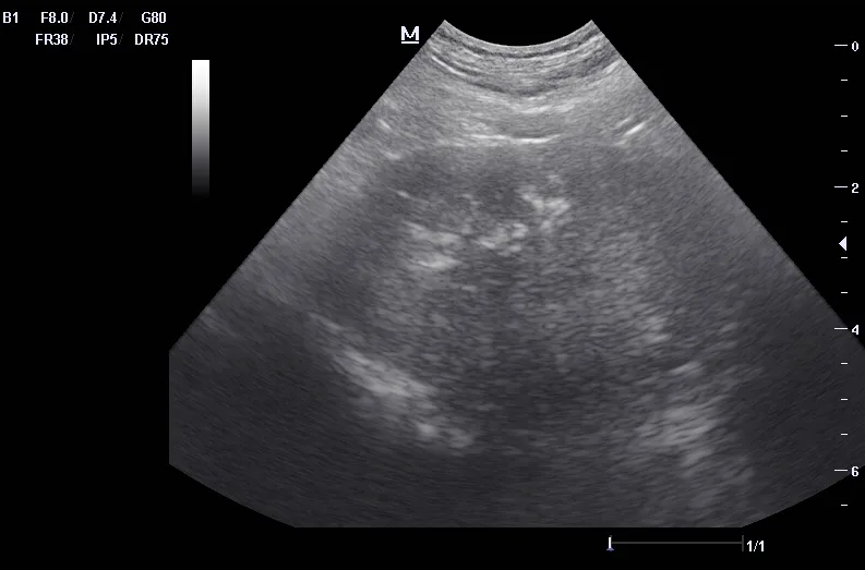 Ultrasound image of a canine prostate exhibiting chronic changes.