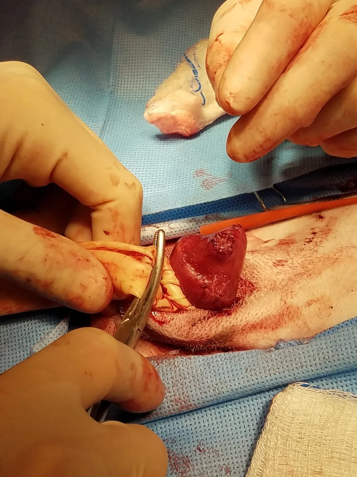 Partially amputated penis of a dog.