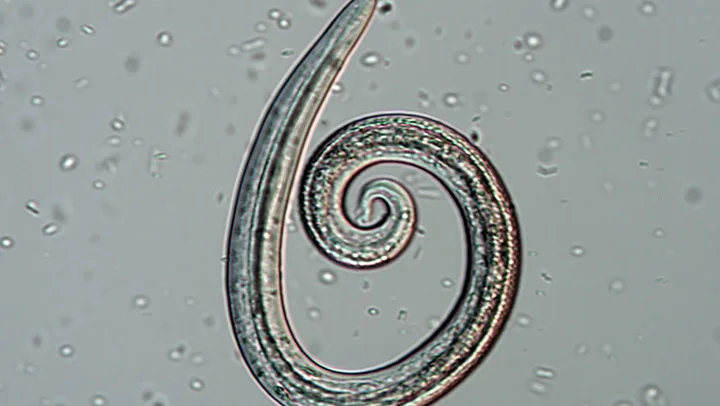 A microscopic image of a coiled parasite larva.