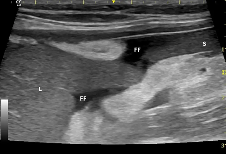 Abdominal ultrasound images from a cat. 