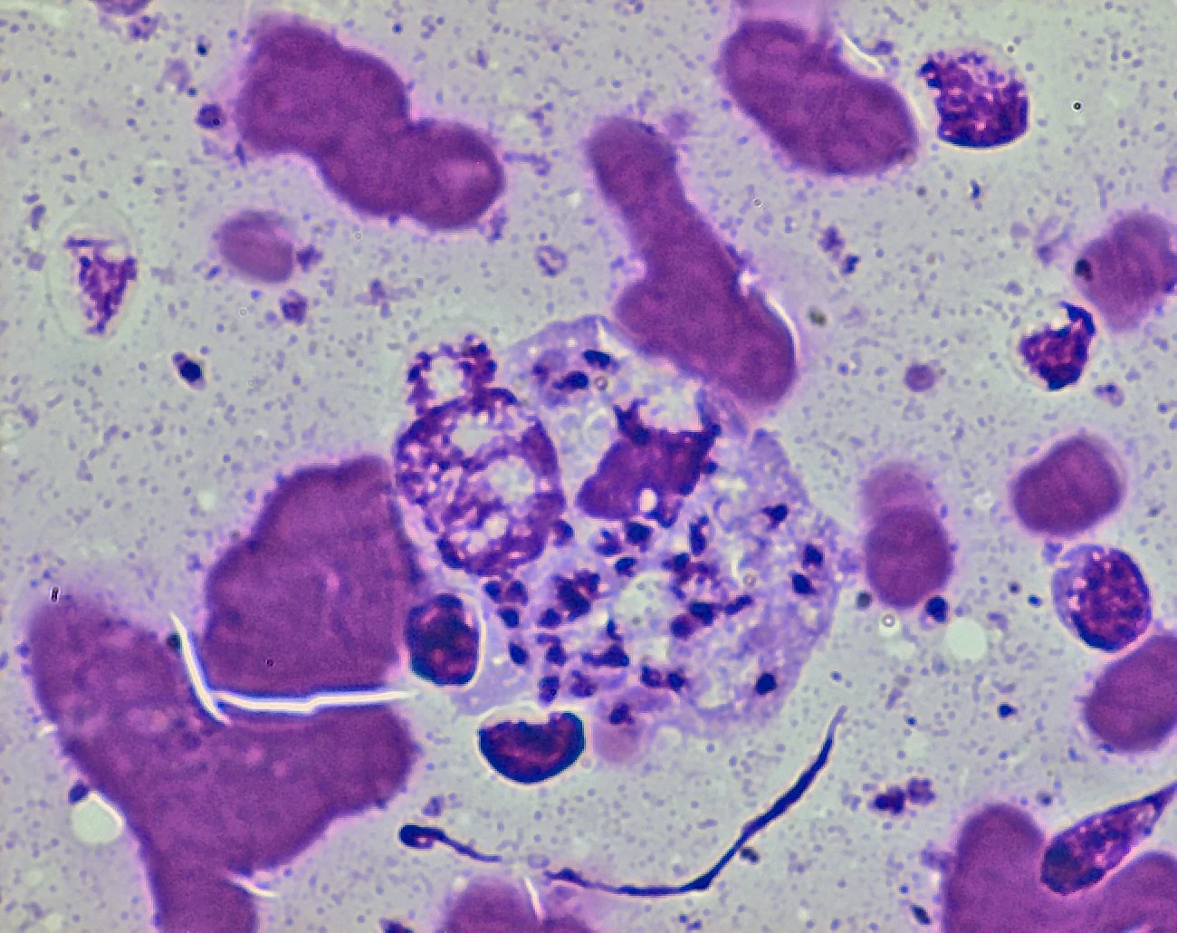 Slide showing amastigotes.