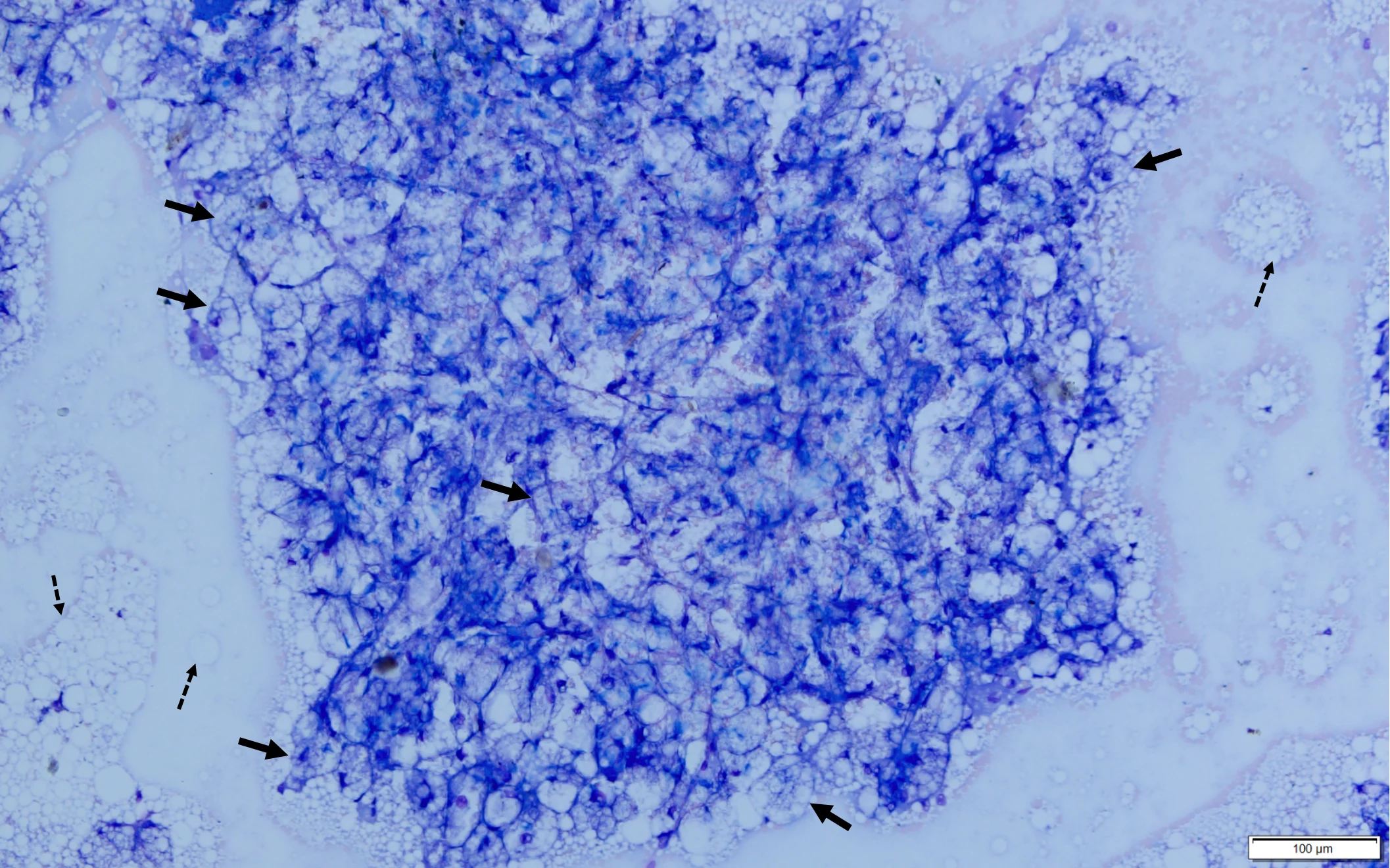 Microscopic image showing cells from a liver aspirate.