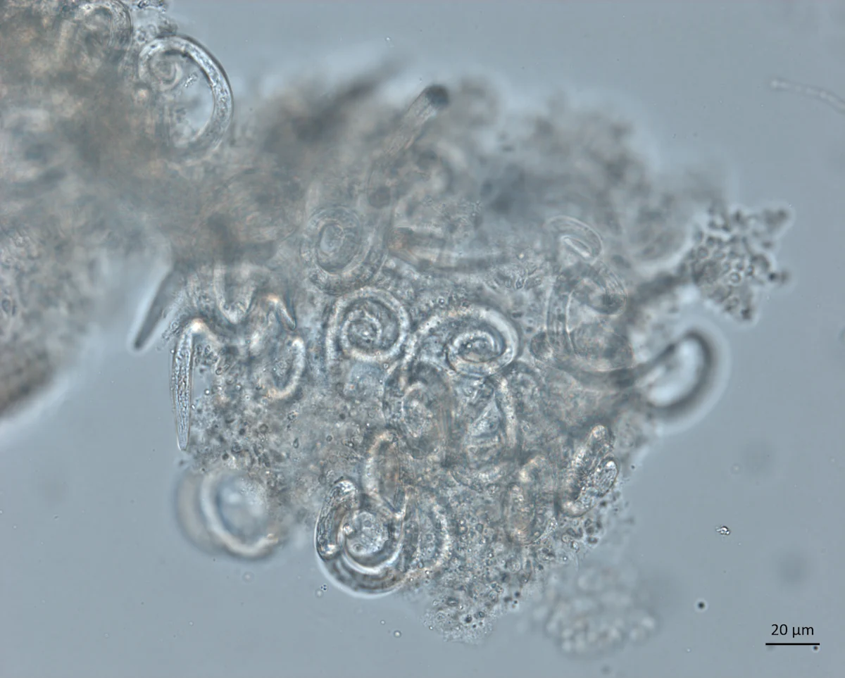 A microscopic image of a cluster of coiled Angiostrongylus cantonensis larvae. 