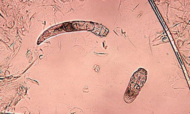 Demodex 2024 injai treatment