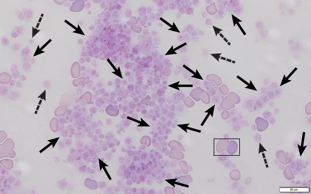 Stained blood smear with arrows pointing to individual platelets and platelet clumps.