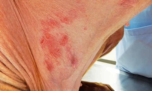 A close-up view of a dog's neck showing multiple red, raised lesions on the skin, indicative of a possible dermatological condition. A veterinarian's hand is partially visible in the background, suggesting an examination or treatment is in progress.