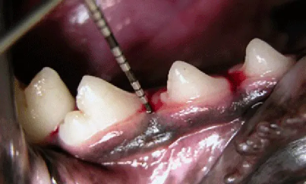 Dental probe being  inserted into sulcus of the right mandibular premolar tooth of a dog.