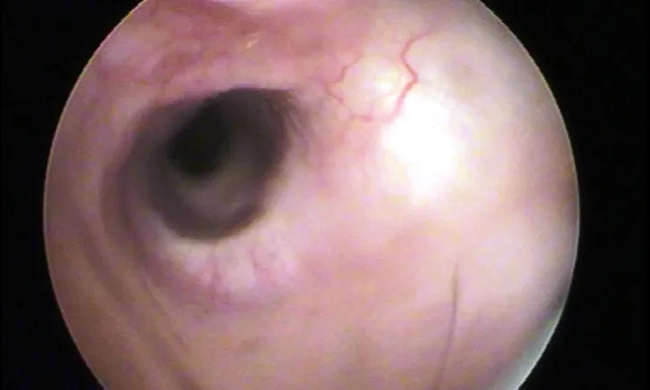 An otoscopic view of a canine ear canal.