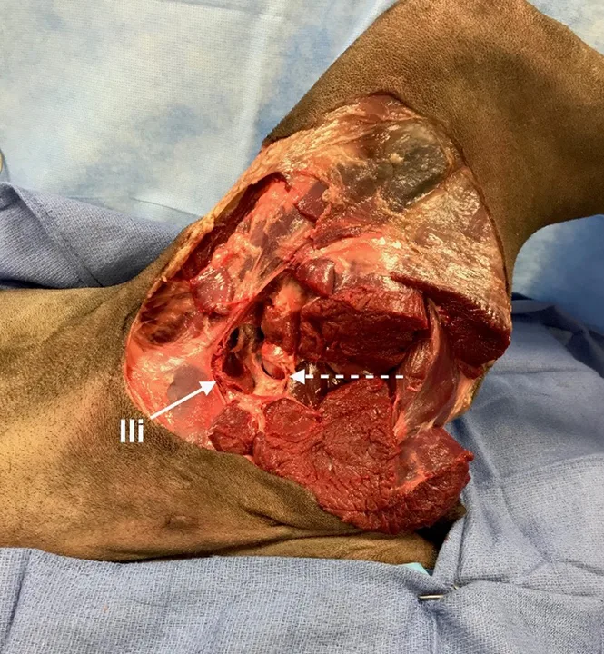 Intraoperative image of medial canine pelvic limb with arrows pointing to iliopsoas muscle and joint capsule.