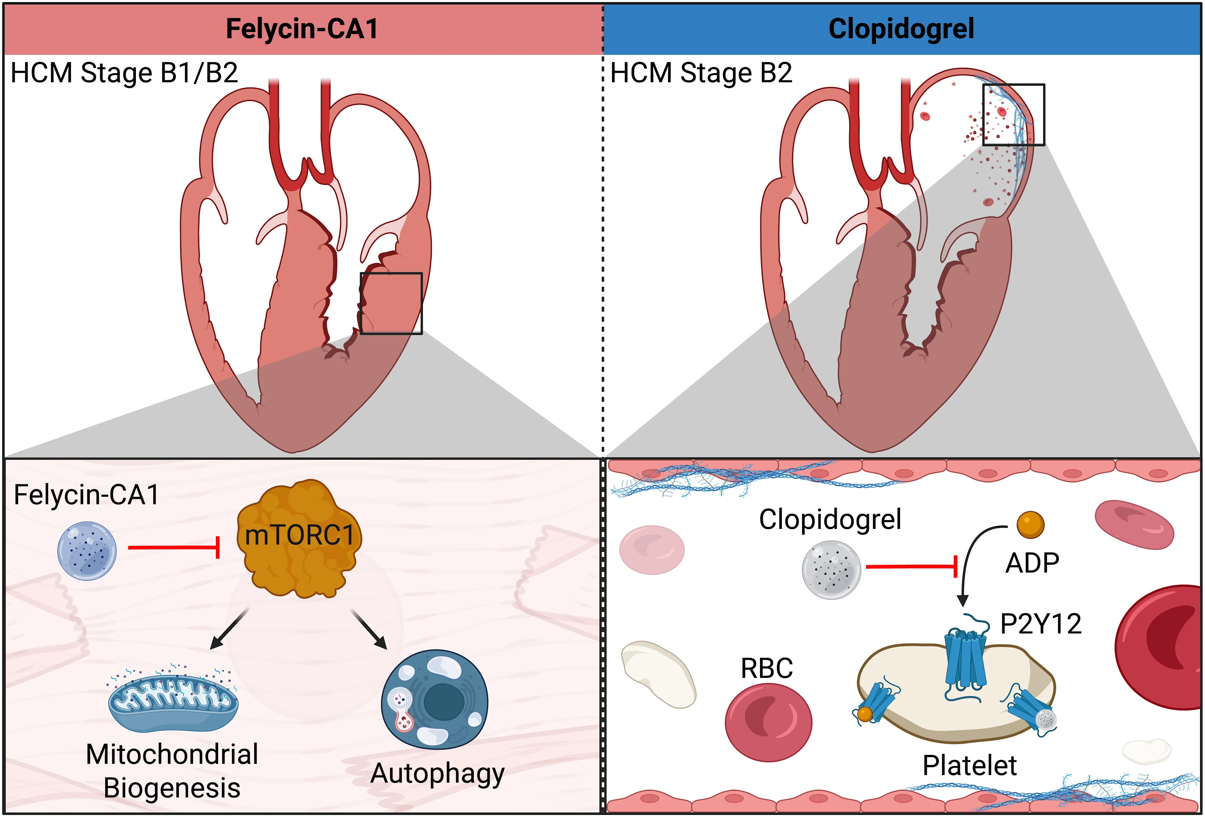 Diagrammatic representation of therapeutic treatment options in subclinical HCM and mechanisms of action for each drug. The subclinical stage for which each therapy is recommended is shown above the representative drug’s mechanism of action.