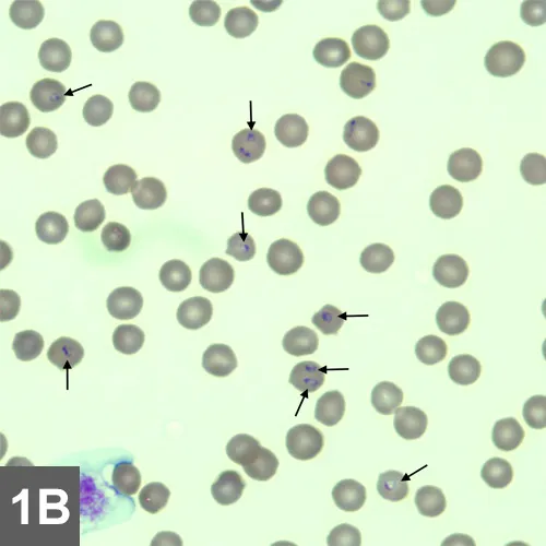 Cytology showing arrows pointing to small basophilic structures located within RBCs.
