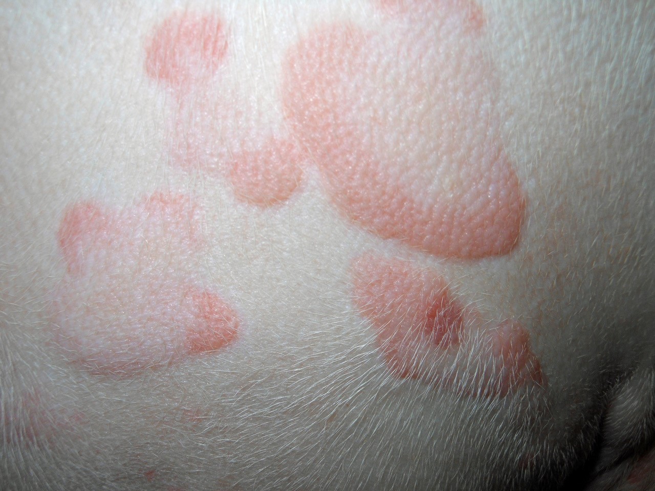 Wheal Skin Lesion Wheal, Skin Lesion