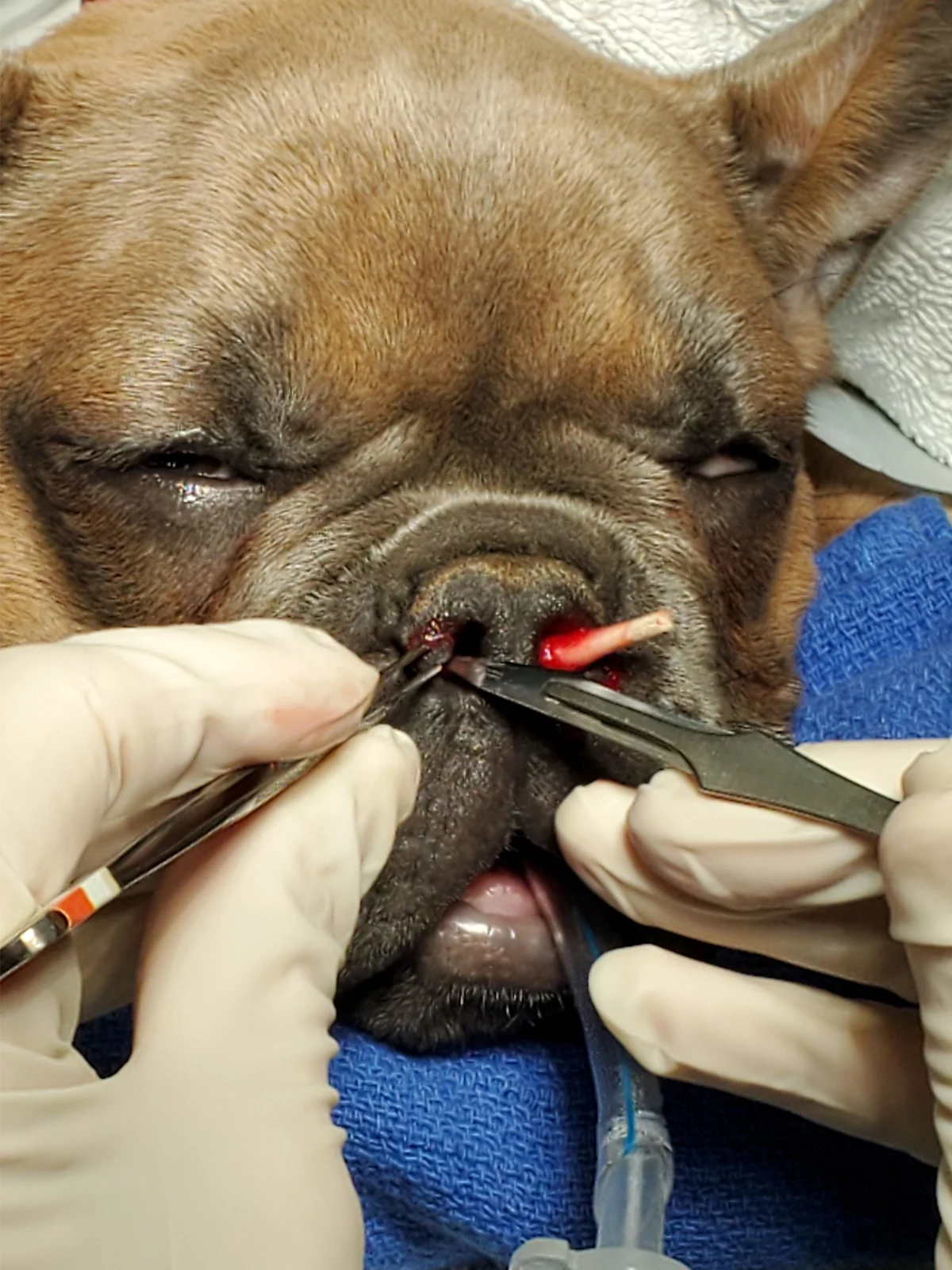 Shortened cotton-tipped swab seen in the left nares of dog while gloved hands begin alar fold resection in the right nares.