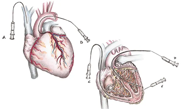 Featured Image