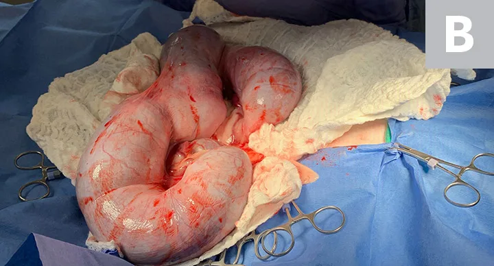 Side-by-side images showing initial C-section incision and exteriorized gravid uterus of a dog.
