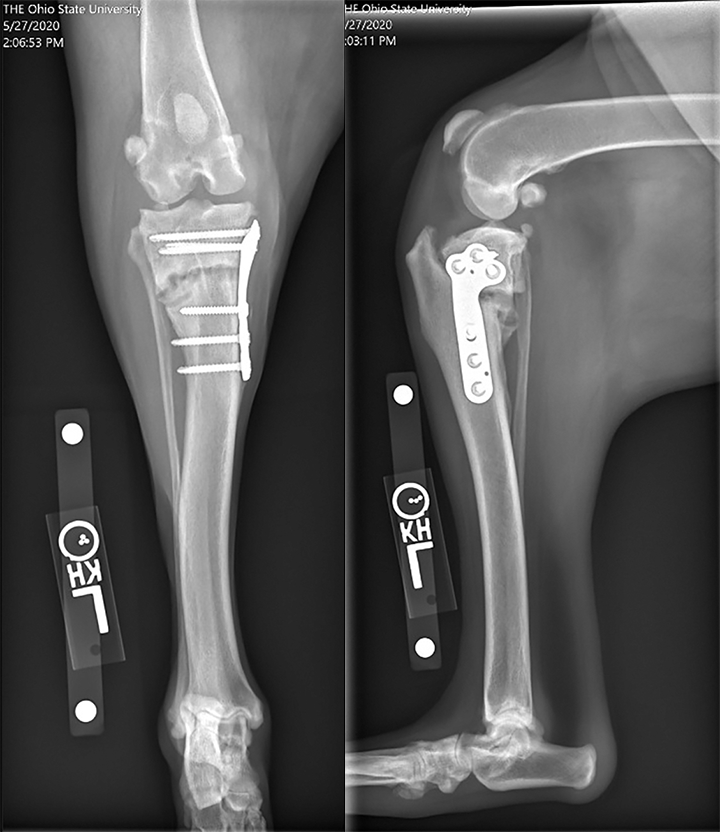 Common Tibial Plateau-Leveling Osteotomy Complications | Clinician's Brief