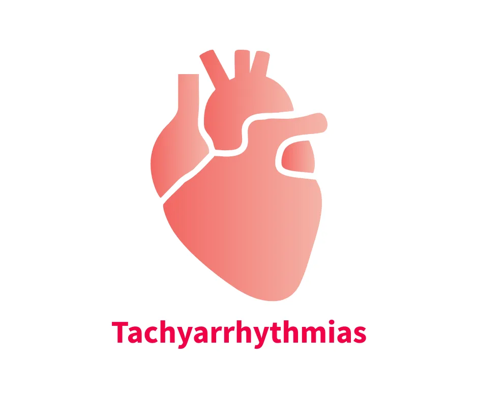 A stylized illustration of a heart, highlighting its anatomical features, accompanied by the text "Tachyarrhythmias" below. The heart is depicted in a gradient of pink shades, emphasizing its structure in a clinical context.