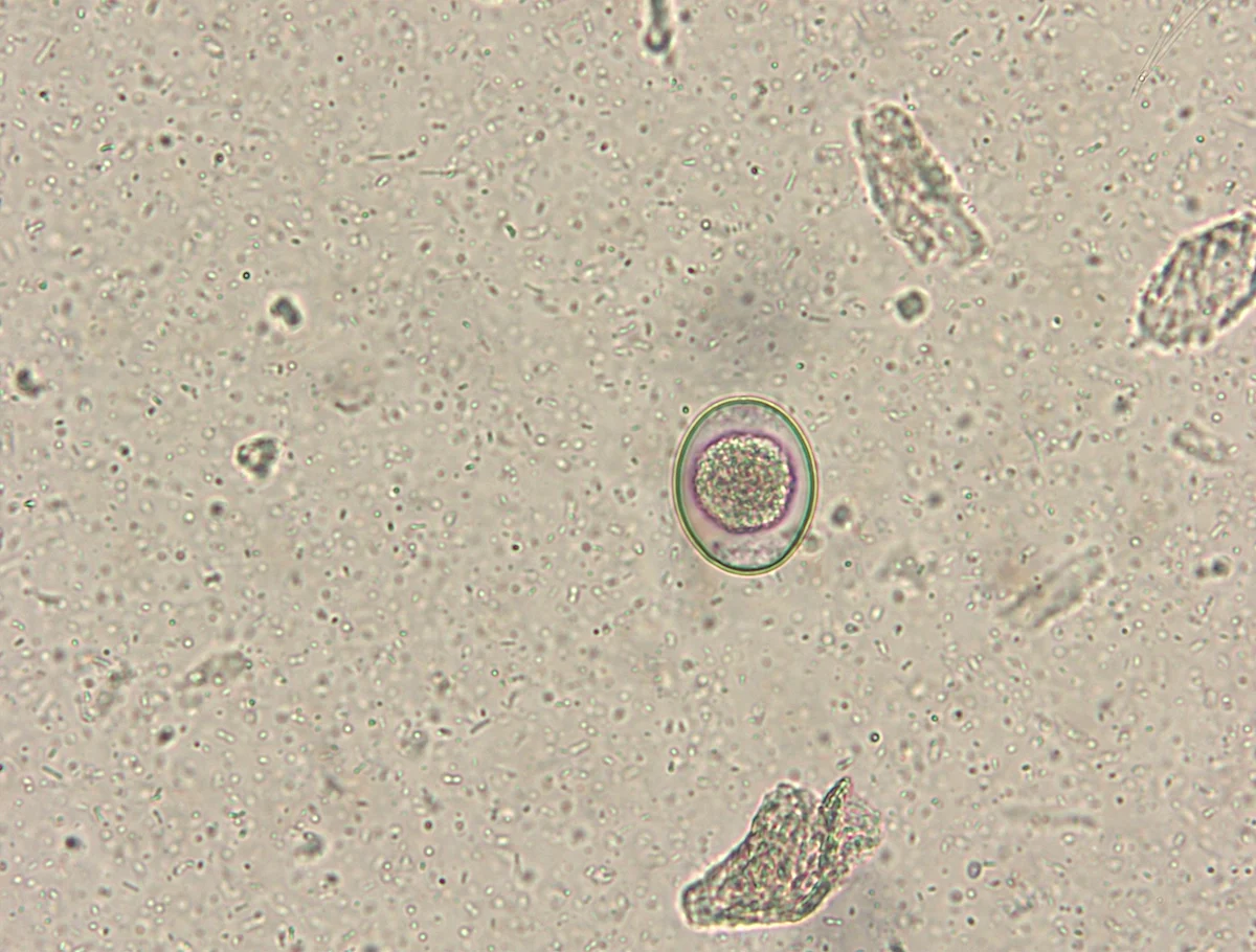 Slide showing an oocyst.