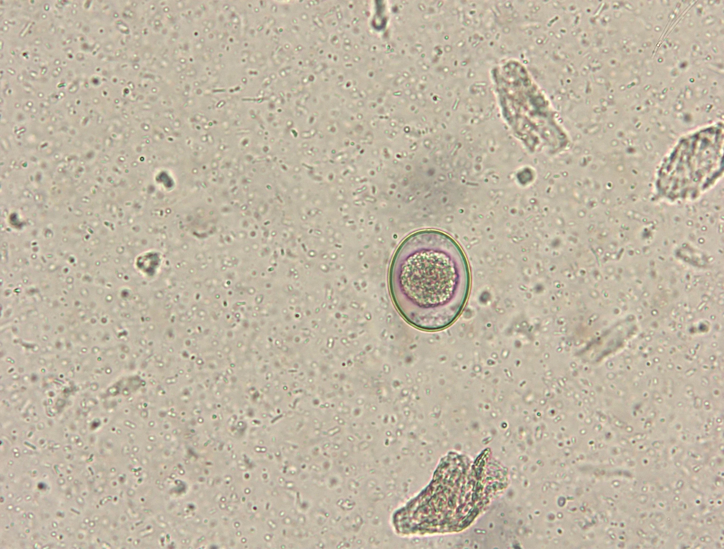 Slide showing an oocyst.