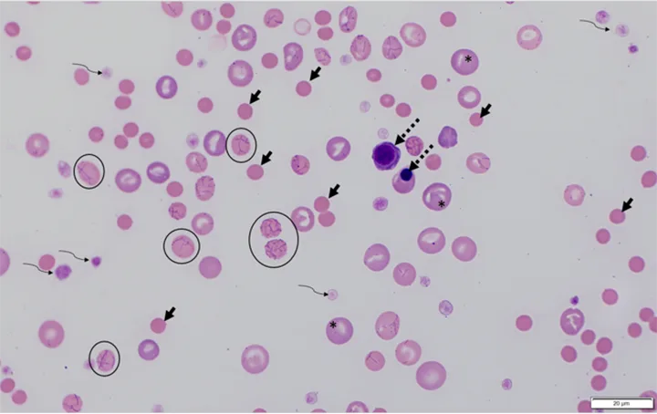 A microscopic image of a blood smear with different cell types identified with circles, asterisks, and arrows.