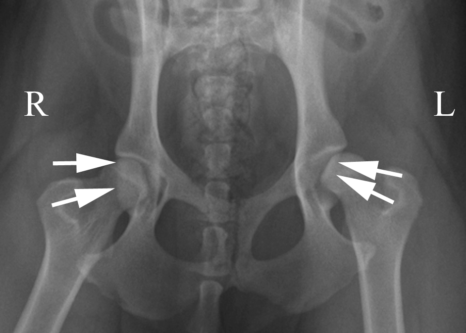 Pelvis x-ray Information